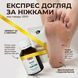 Набор для педикюра - пилинг (кислота) и крем для ног с аргановым маслом 25151 фото 1