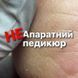 Набор для педикюра - пилинг (кислота) и крем для ног с аргановым маслом 25151 фото 2